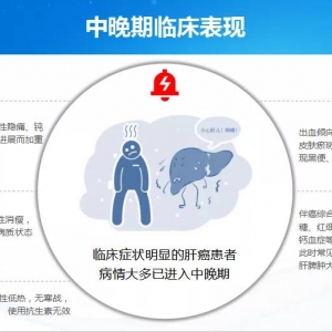 《中国抗癌协会原发性肝癌患者指南》解读（一）-基础及诊断 ...